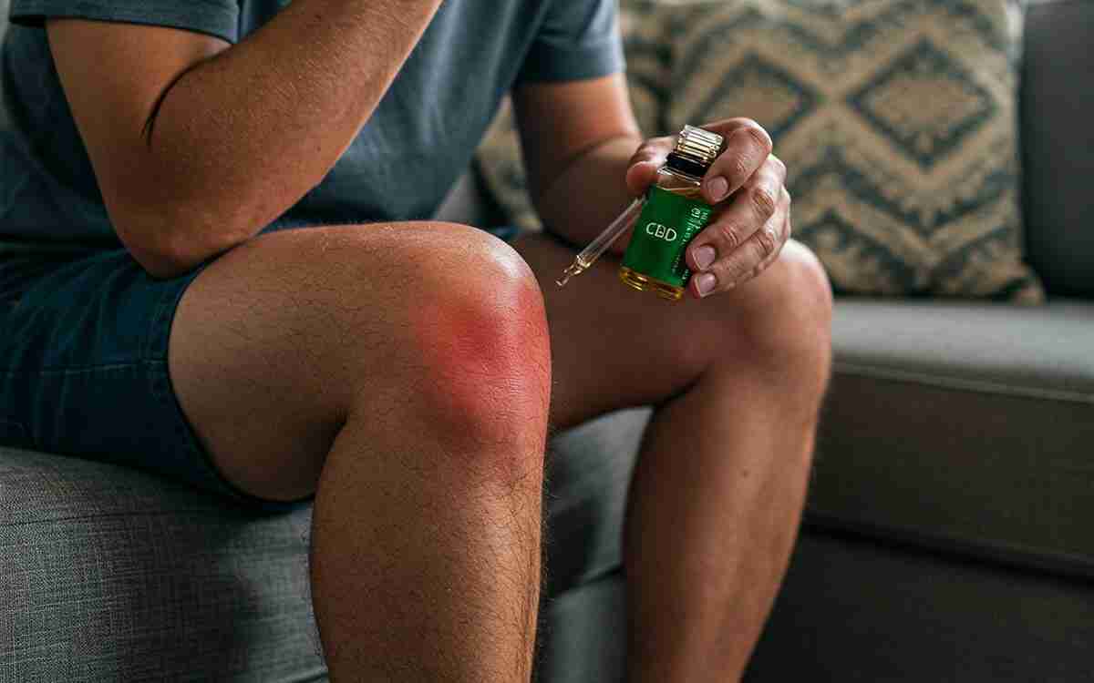 CBD: antinfiammatorio naturale ottimo anche per il dolore cronico